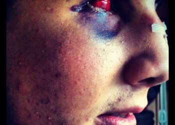 rory_macdonald