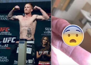 Ed Herman finger UFC MMAnytt