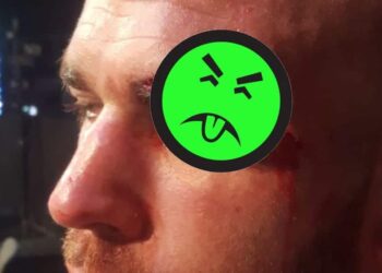 Jack Mason Worst Cut Ever In MMA Cage Warriors 93 MMAnytt