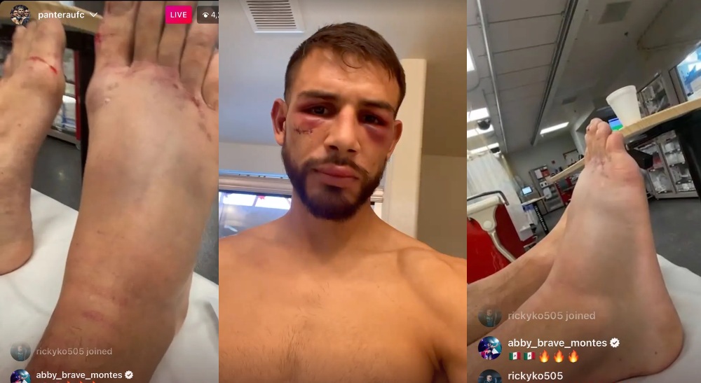 Yair Rodriguez MMAnytt