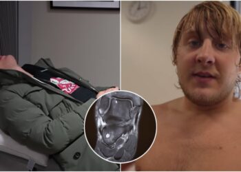 Paddy Pimblett