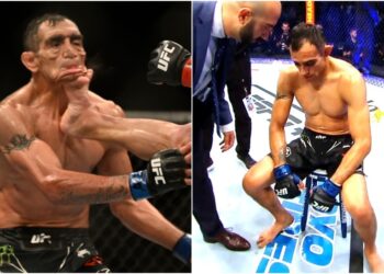 Tony Ferguson