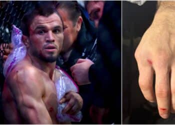 Umar Nurmagomedov bröt handen mot Merab Dvalishvili på UFC 311