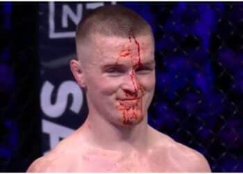 Reaktioner efter slagfesten mellan Nurmagomedov och Hughes