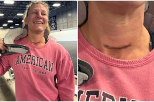 Kayla Harrison med halskrage visar operationsarr