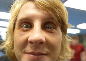 Paddy Pimblett efter UFC 324 i buren